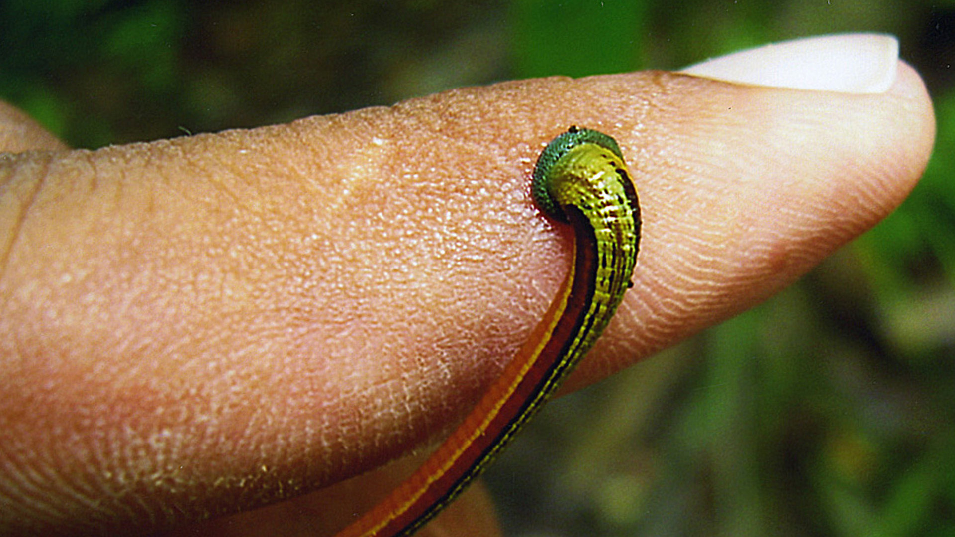 Disgustingly Healthy: The Leech Remedy